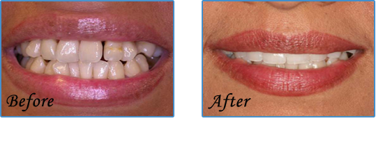 Before treatment